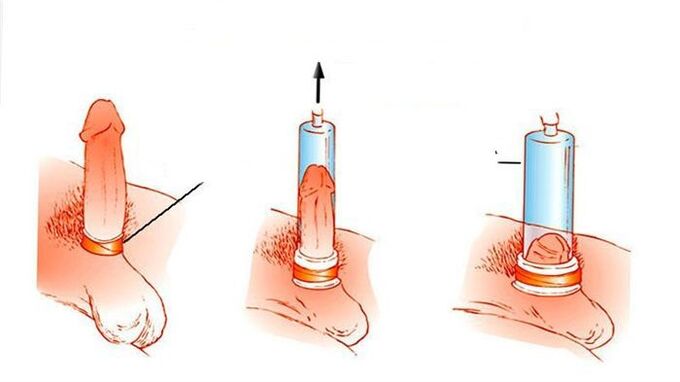 comment fonctionne une pompe à vide